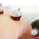 Wet Cupping (General Hijama)